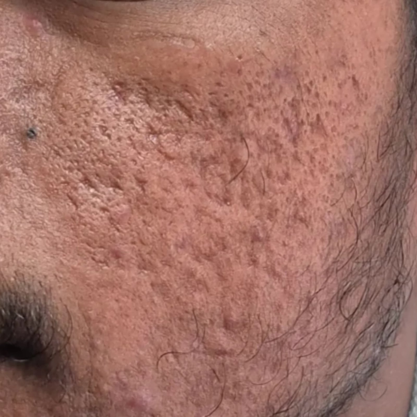 Scars Before